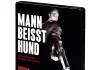 Mann beißt Hund